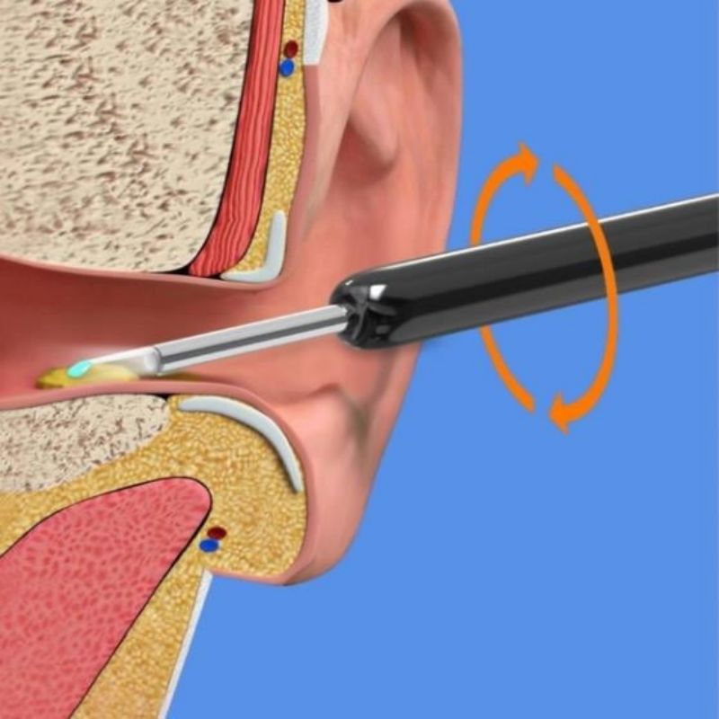 Clear ear otoscope